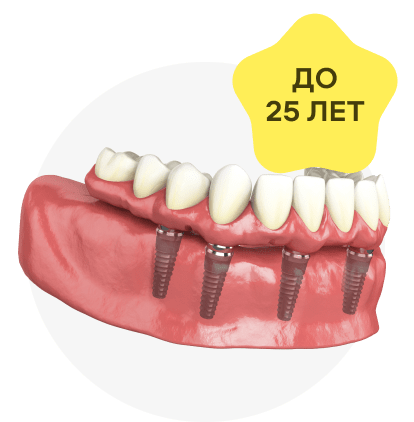 Гарантия на коронки и протезы